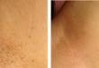 Восковая депиляция для гладкой кожи подмышек: подготовка и особенности выполнения Средства для эпиляции подмышек