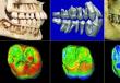 Сравнение черепа человека с черепами антропоморфных обезьян Череп обезьяны